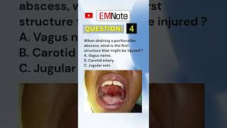 Draining Peritonsillar Abscess medical doctor nursing [upl. by Nelram]