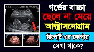 আল্ট্রাসনোগ্রাফি রিপোর্ট দেখে সহজে জেনে নিন গর্ভের সন্তান ছেলে না মেয়ে  ultrasonography report [upl. by Sierra]