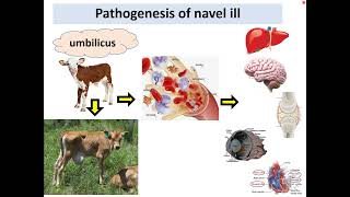 Navel ill joint ill omphalophlebitis [upl. by Felice]