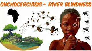 Onchocerciasis  River Blindness [upl. by Loni274]