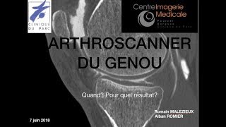 Arthroscanner du genou Alban ROMIER [upl. by Llirred]