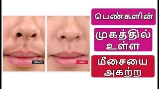 அரும்பு மீசை வருகிறதா  How to Remove Upperlip Hair  Unwanted Facial Hair Removal Naturally [upl. by Cyril621]