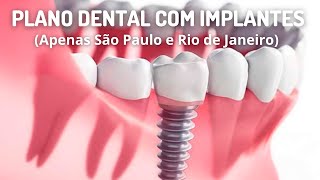 Plano Odontológico que cobre Implantes Dentários [upl. by Heilner]