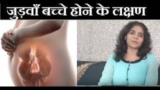 जुड़वाँ बच्चे होने का आसान तरीका  Twins Pregnancy and Symptoms [upl. by Alemap225]