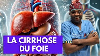 Tout ce que vous devez savoir sur La cirrhose du foie par docteursourire [upl. by Llehcsreh591]