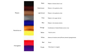 Pigmented structures in dermoscopy and their correlation [upl. by Tan]