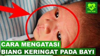 CARA MENGATASI BIANG KERINGAT PADA BAYI [upl. by Ashti]