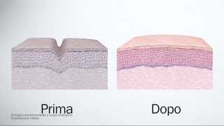 Fillerina Biorevitalizing  Trattamento effetto filler dermocosmetico ed effetto biorivitalizzante [upl. by Noseaj]