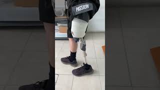 Transfemoral amputee rehab shorts legprosthesis prosthesis artificialleg prosthetics [upl. by Dnumyar104]