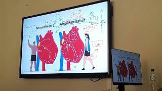 Fibrilación Auricular  Cardiología [upl. by Levram]