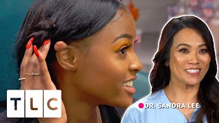 Dr Lee Helps Teenager With Cutest Keloids Shes Ever Seen  Dr Pimple Popper Pop Ups [upl. by Anaik]