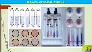 Precipitation and Agglutination Tamil Part 4 [upl. by Eltsyek327]