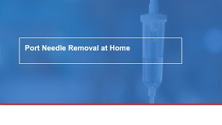 Port Needle Removal at Home [upl. by Av373]