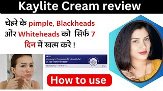 Clinmiskin Gel Uses in Hindi  Clindamycin Phosphate amp Nicotinamide Gel  how To Use  Side Effects [upl. by Herald]