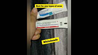 shorts Benefits of Adapalene gel 01 Differin gel for acne adapalene differingel [upl. by Ledniahs]