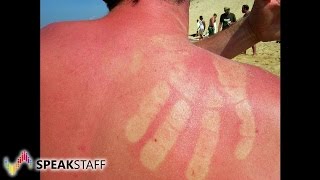 Sonnenallergie – Wenn die Strandferien zur Qual werden [upl. by Aniar]