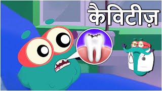 कैविटीज़  दांतों में कीड़े  Cavities In Hindi  DrBinocs Show  Educational Videos For Kids [upl. by Okir378]