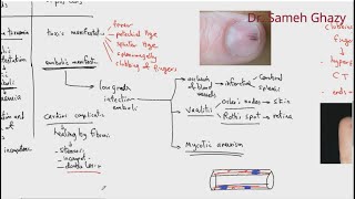 Systemic pathology 4  CVS infective and noninfective endocarditis DRSAMEH GHAZY [upl. by Elysee]