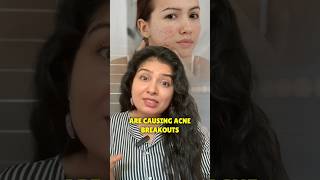 Do You Know These Wrong Habits Causing Acne 😲 skincaretips [upl. by Leiahtan]