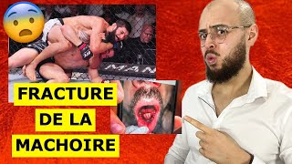 Robert WHITTAKER  sa fracture de la mâchoire impressionnante causée par Khamzat Chimaev  😱 [upl. by Freddie]