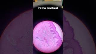 Patho granulation tissue slide 2nd yr mbbs mbbs mbbsmotivation viralvideo [upl. by Atworth]