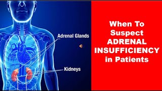 When To Suspect ADRENAL INSUFFICIENCY in Patients [upl. by Malim507]