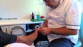 Ian Fowler Chiropodist at The Therapy Company demonstrates his work [upl. by Kassi54]