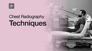 Chest Radiography Techniques [upl. by Fitton]