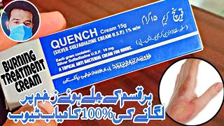 Burning Treatment jale Huwe Zakham or unke Nishant Khatam 100 Quench Cream Benefits UrduHindi [upl. by Senecal105]