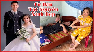 Chàng trai trẻ chấp nhận lấy cô vợ tật nguyền và hạnh phúc ko trọn vẹn [upl. by Kaiser648]