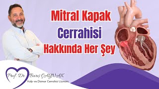 Prof Dr Barış Çaynak  Mitral Kapak Cerrahisi Hakkında Bilmeniz Gereken Her Şey [upl. by Kciredorb]