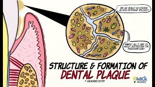 Dental Plaque Structure and Formation [upl. by Vassili]