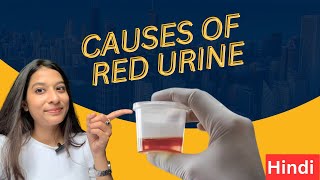 Causes of Red Urine  What is Hematuria by Dr Prachi Mahajan [upl. by Damalus]