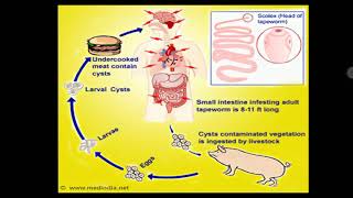 Neurocysticercosis [upl. by Lindy98]