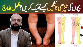 Bachon Ki Terhi Legs Kaise Theek Kareen Complete Treatment [upl. by Penney]