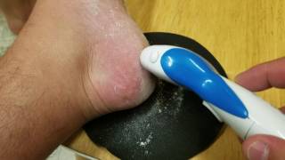 Polishing Left heel with Ped Egg Power [upl. by Dominique]