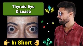 Thyroid Eye Disease [upl. by Matthiew459]