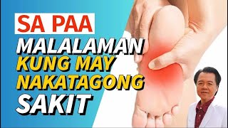 Sa Paa Pwede Makita kung may Nakatagong Sakit  By Doc Willie Ong [upl. by Alleunamme]