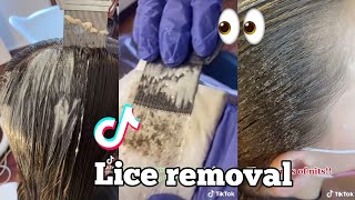 lice removal tiktok compliation‼️👀☹️ [upl. by Pedaiah124]