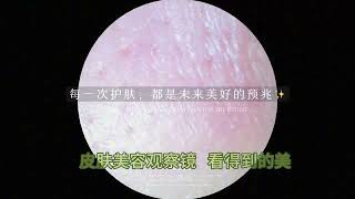 Cosmetic Dermatology Observation Scope [upl. by Atinauj]