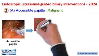 ENDOSCOPIC ULTRASOUNDGUIDED BILIARY INTERVENTIONS  2024 [upl. by Fiedling]