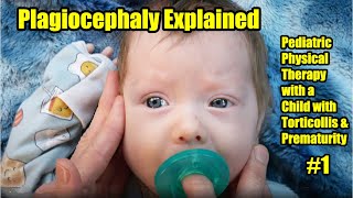 1 Plagiocephaly Explained Pediatric Physical Therapy with a Child with Torticollis amp Prematurity [upl. by Barty]