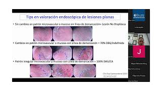 Viernes académico Nuevos conceptos en el manejo del esofago de Barrett Dr Germán Junca [upl. by Still]