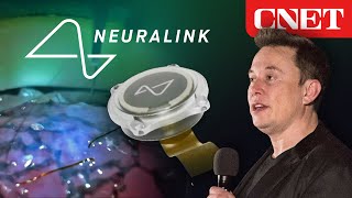 Elon Musk’s Neuralink Event Everything Revealed in 10 Minutes [upl. by Ociram]