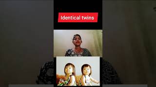 monochorionoc Diamniotic twins pregnancy kya hoti hai identical twins pregnancy dizygotic twins preg [upl. by Oribel]