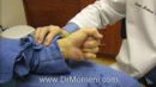 Needle Aponeurotomy Dupuytrens Contracture  New Jersey [upl. by Dunseath]