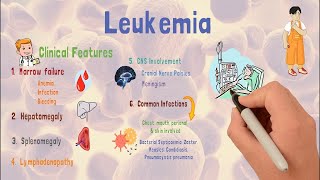 Leukemia  Causes  Types  Early signs amp Treatment [upl. by Ainotal842]