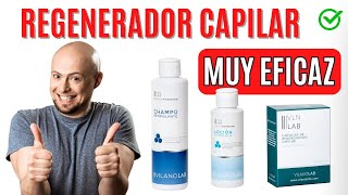 Tratamiento para la ALOPECIA  ✅ MUY EFECTIVO [upl. by Nimrak]