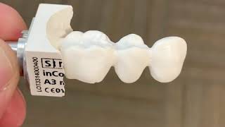 2 Minutes of CEREC Zirconia bridge building amazingness [upl. by Derwon983]