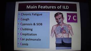 HYPERSENSITIVITY PNEUMONITIS [upl. by Lipman]